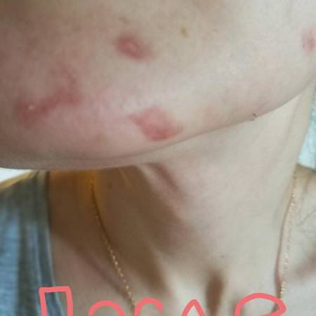 Acne Dote, Invisible Treatment Gel, Oil-Free