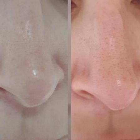 Elizavecca, Milky Piggy Carbonated Bubble Clay Mask, 100 g Review